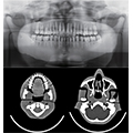 Fantôme Tête pour Radiographie